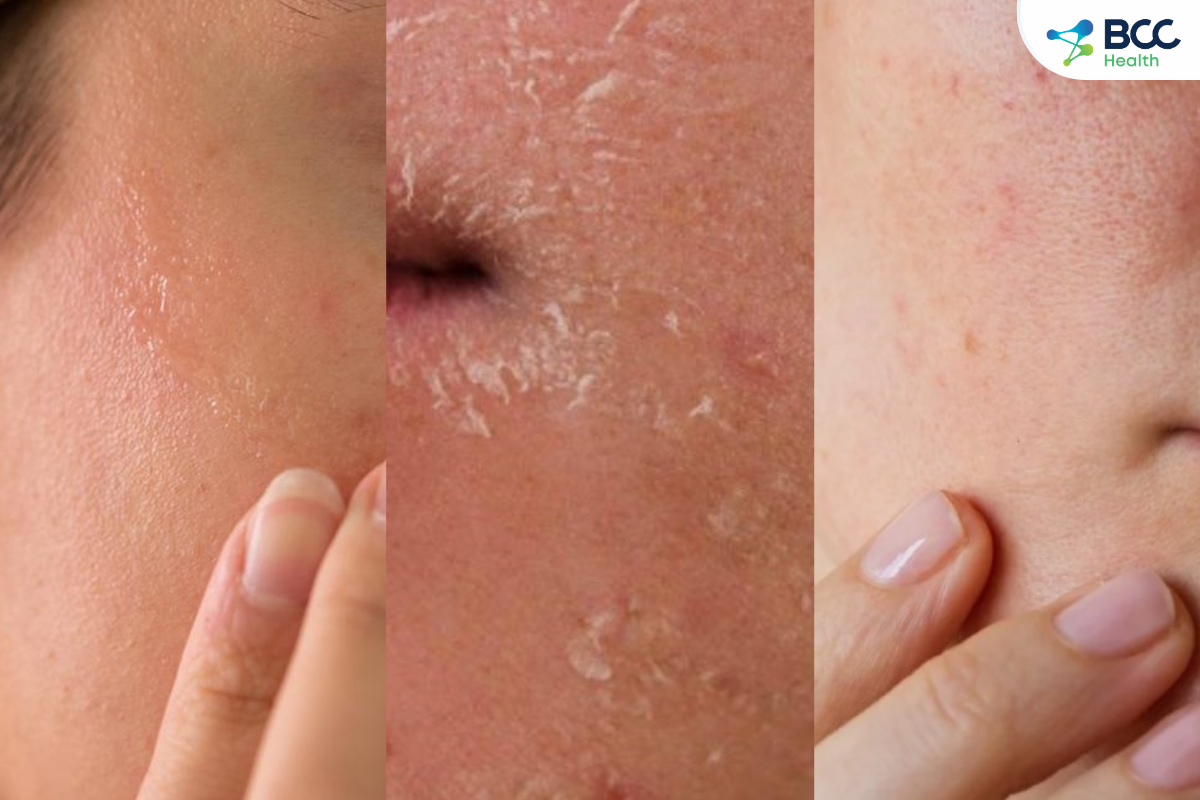 Công dụng của beta glucan dối với làn da